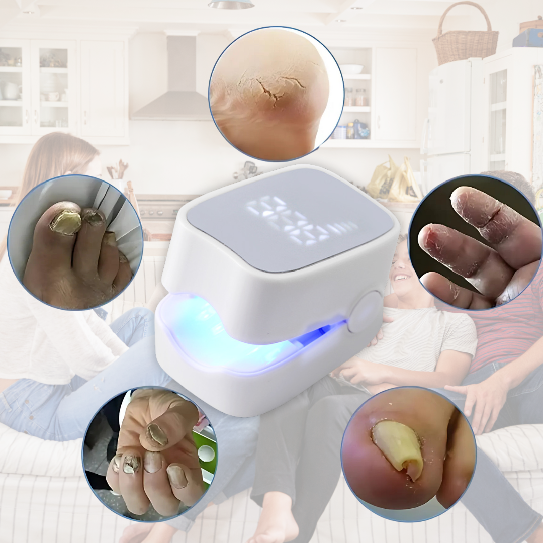 Aparelho a Laser Combate os Fungos das Unhas Heallthy Foot