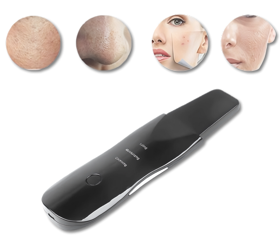 Espátula Facial Removedora de Cravos Peeling