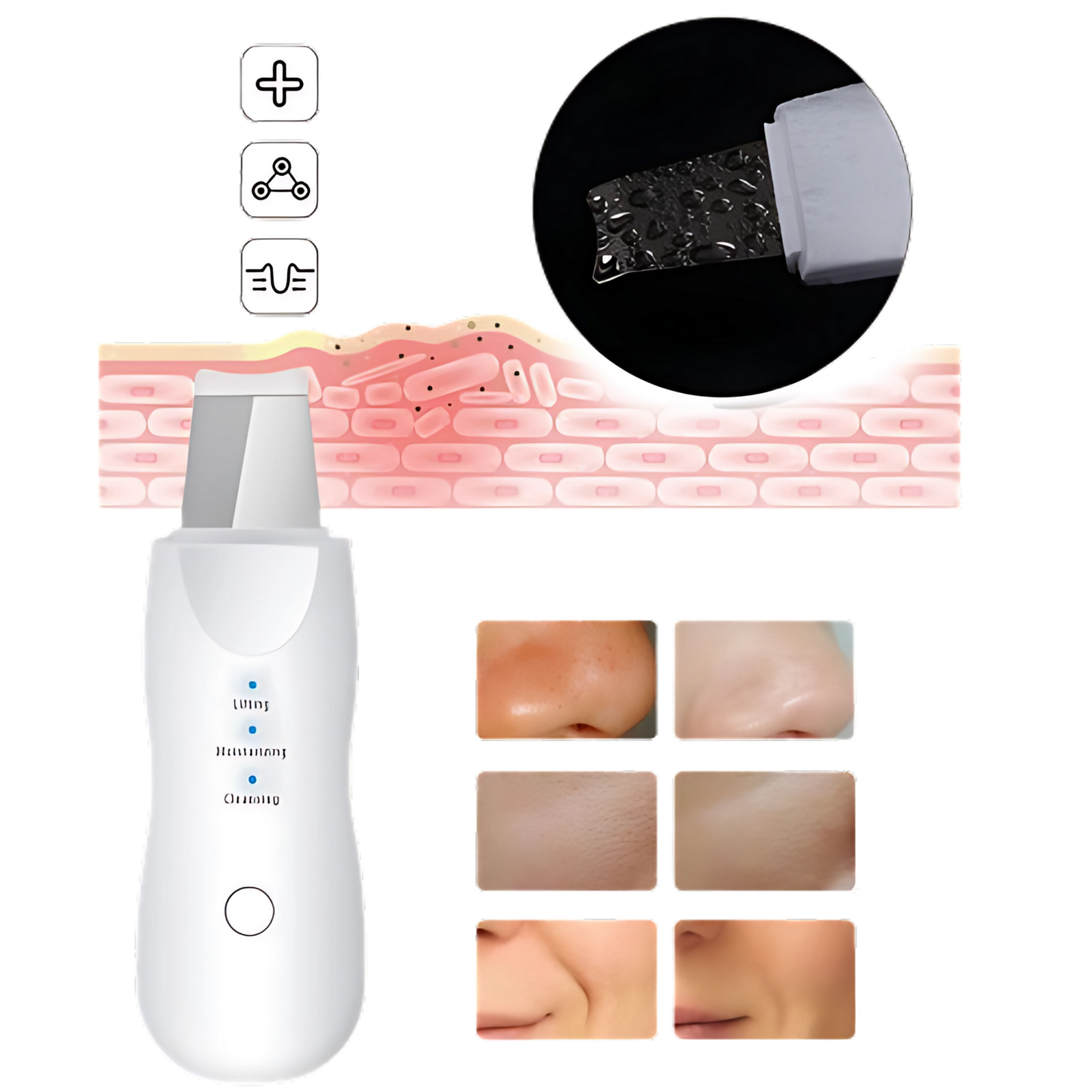 Espátula Facial Removedora de Cravos Peeling
