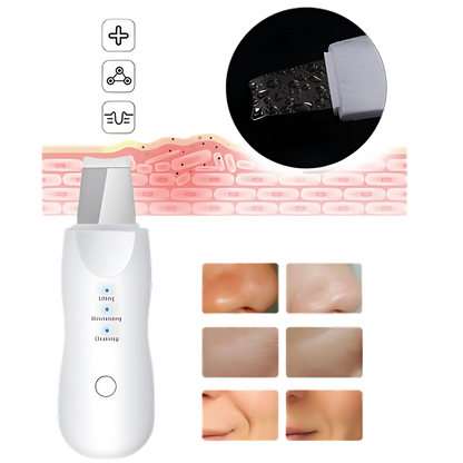 Espátula Facial Removedora de Cravos Peeling